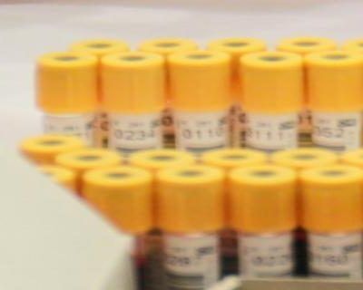 Bloodborne Pathogens in First Response Environments